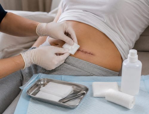 Îngrijirea plăgilor postoperatorii: recomandări pentru vindecare corectă și prevenirea complicațiilor